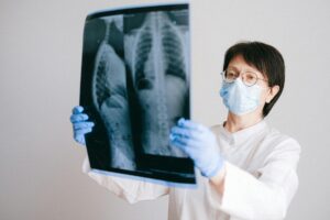 a doctor looking at an x ray result